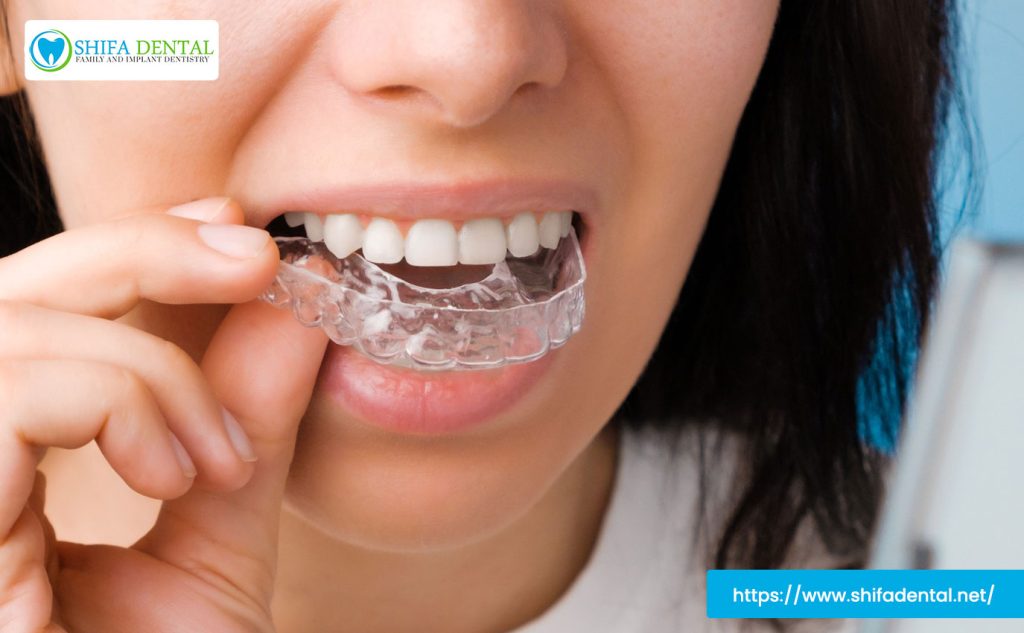 invisalign-vs-braces-plano