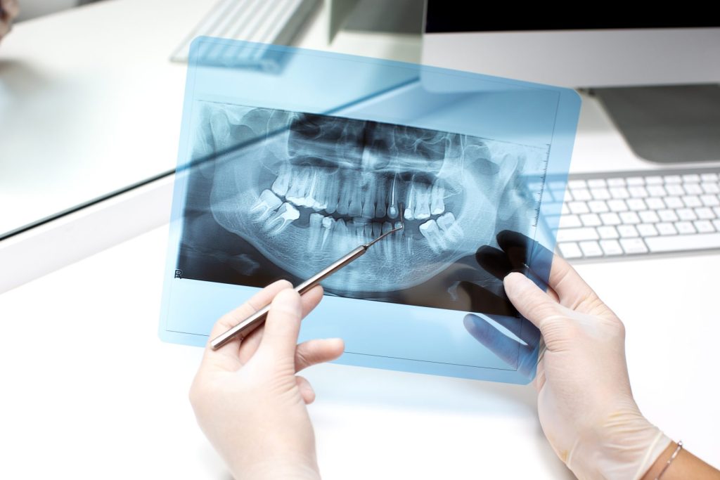 Dental X-Rays in Garland