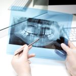 Dental X-Rays in Garland