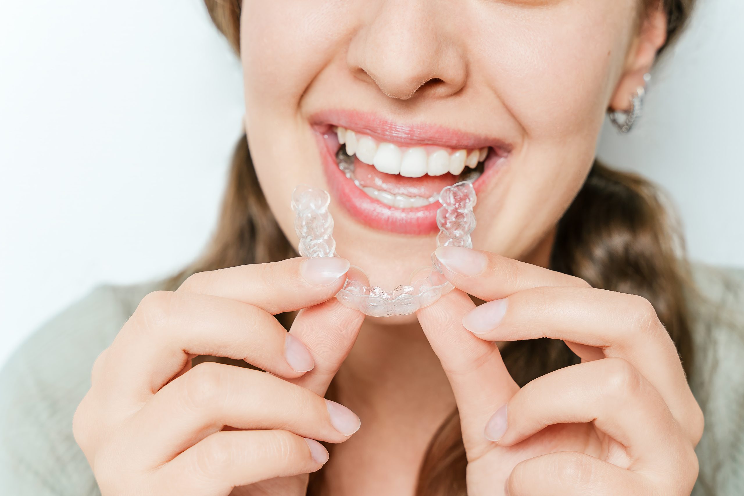 Affordable Teeth Straightening in Plano
