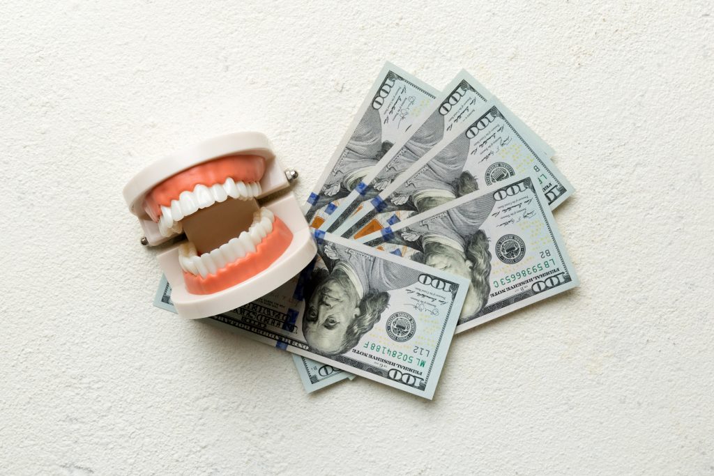 Cost of Affordable Invisible Aligners