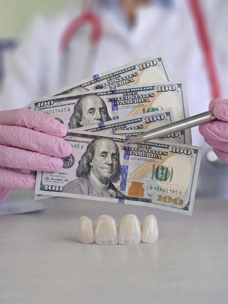 porcelain Veneers Cost