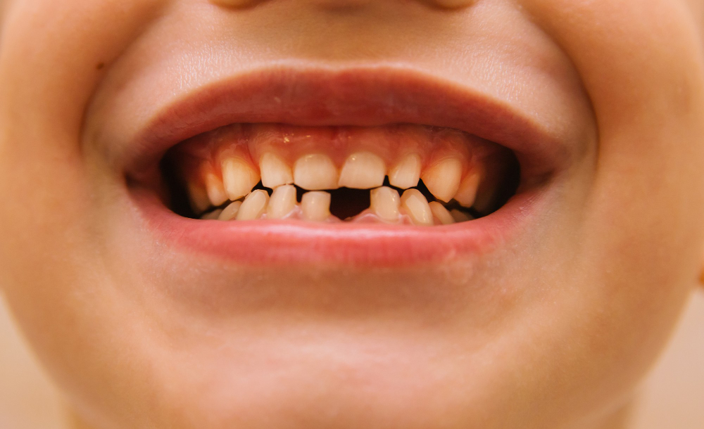 Emergency Dentist