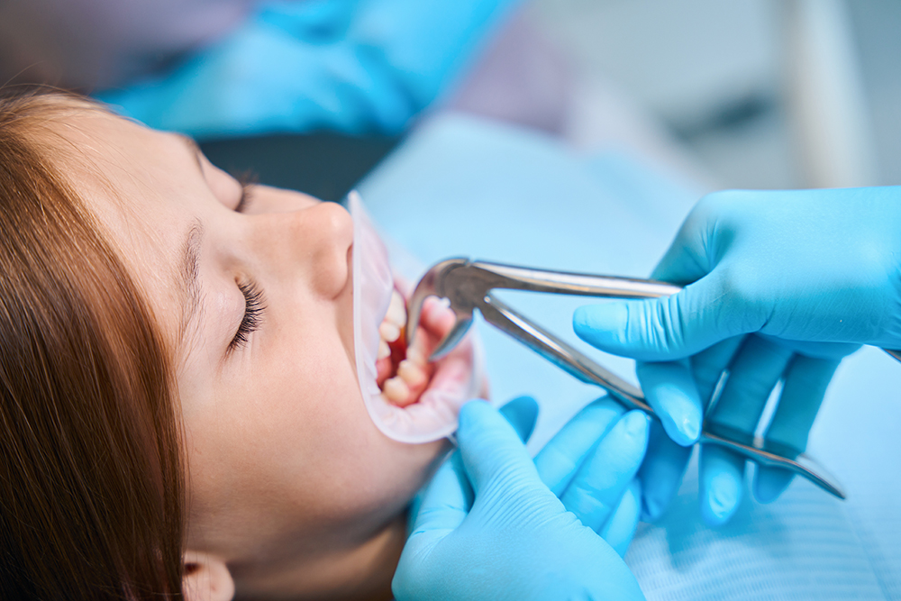 Same-Day Affordable Dental Extractions