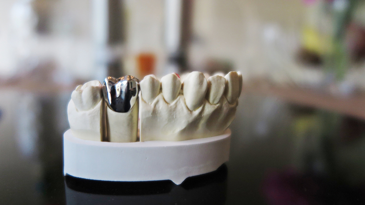 Walk In Emergency Dentist