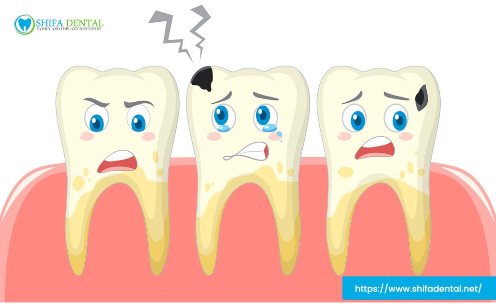 damaged teeth treatment