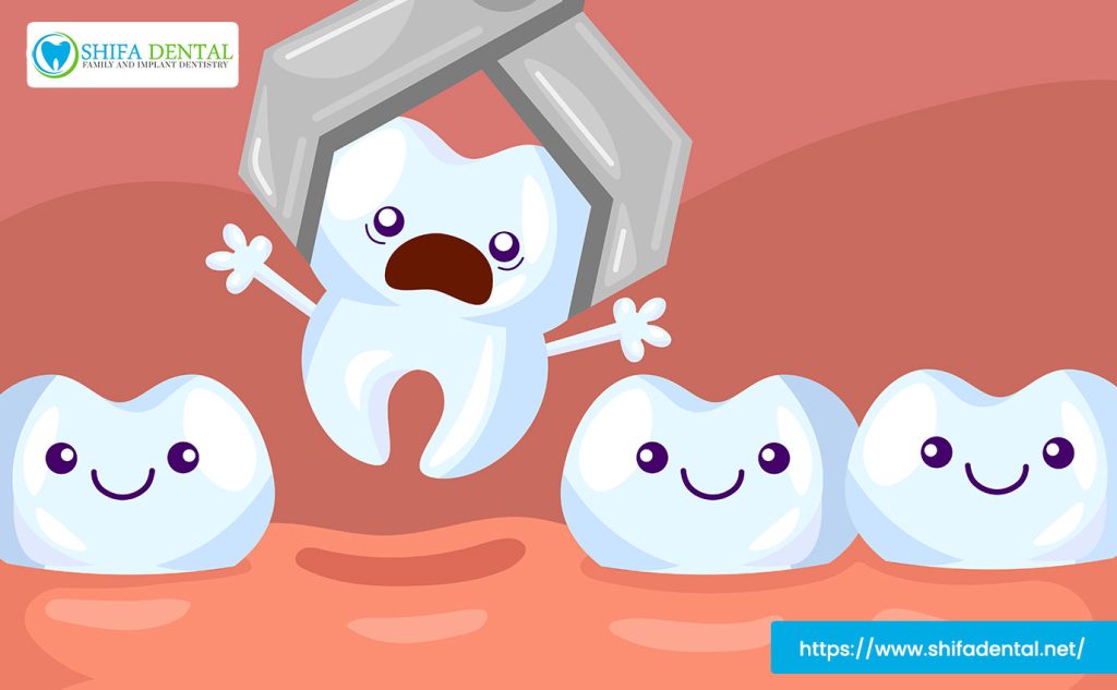 tooth extraction in plano