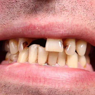 Cosmetic Dentistry
