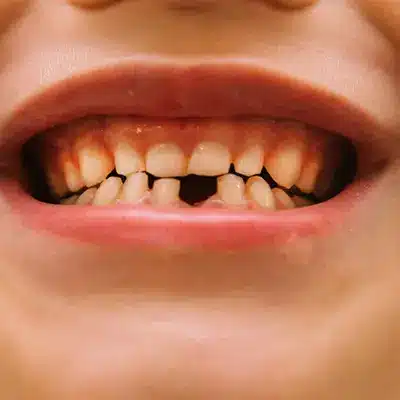 Dental Emergency