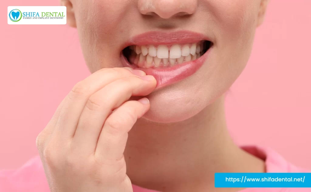Oral Exam for Persistent Bad Breath