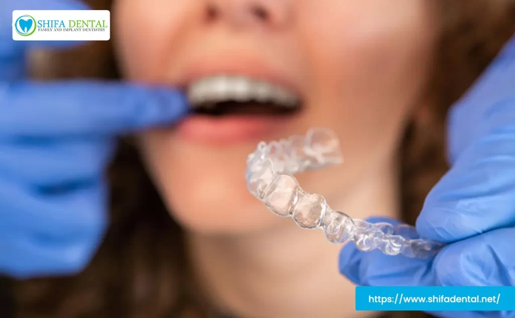 invisalign garland tx