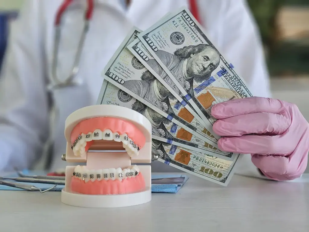 Cost of Dental Metal Brackets