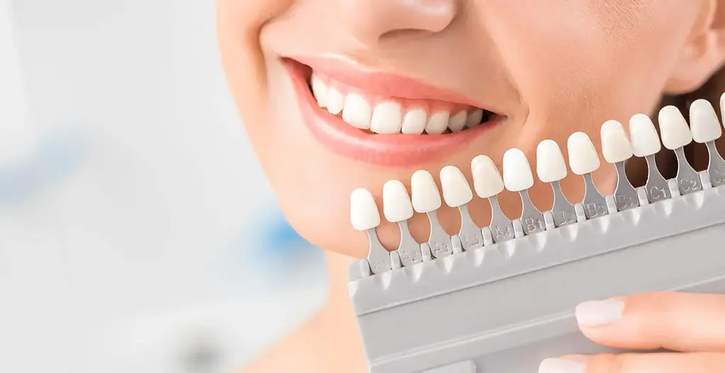 Cost of In Office Teeth Whitening In Garland