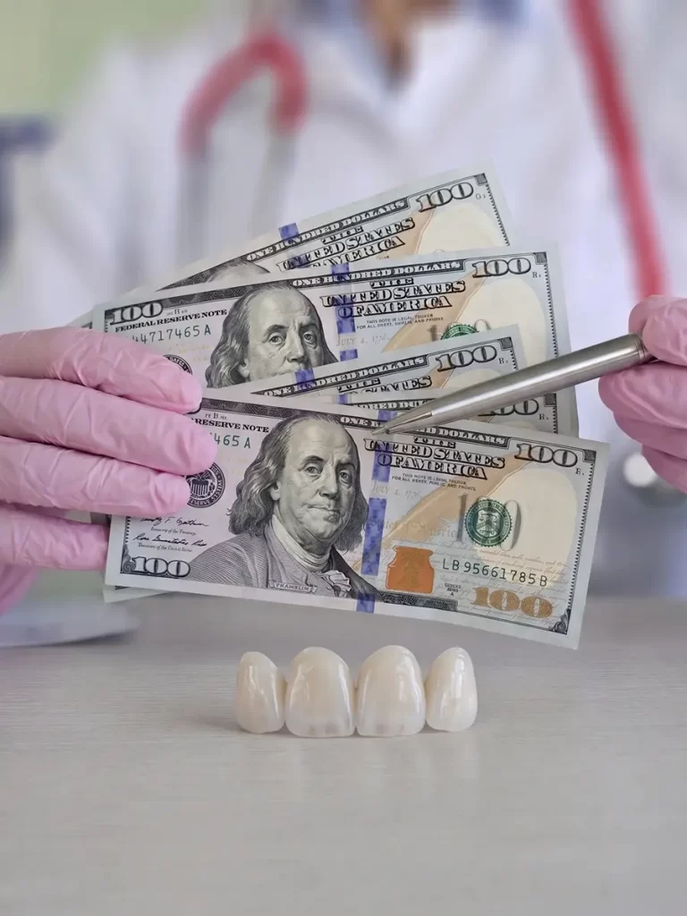 porcelain Veneers Cost
