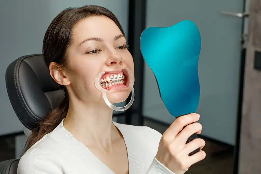 Cost of Metal Braces In Garland