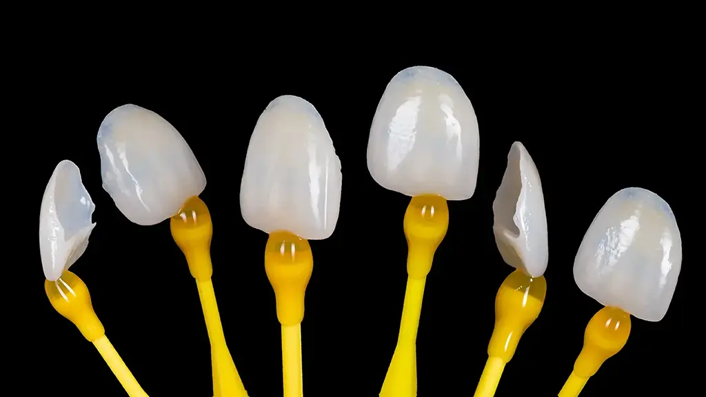 Cost of Veneers In Garland