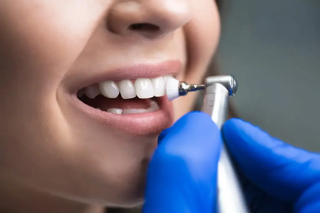 Cost of Teeth Cleaning In Garland