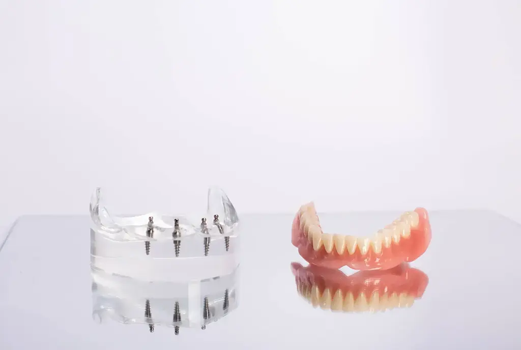 Implant Over Denture In Garland
