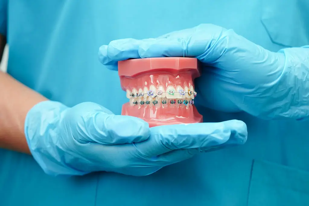 Metal Braces In Garland