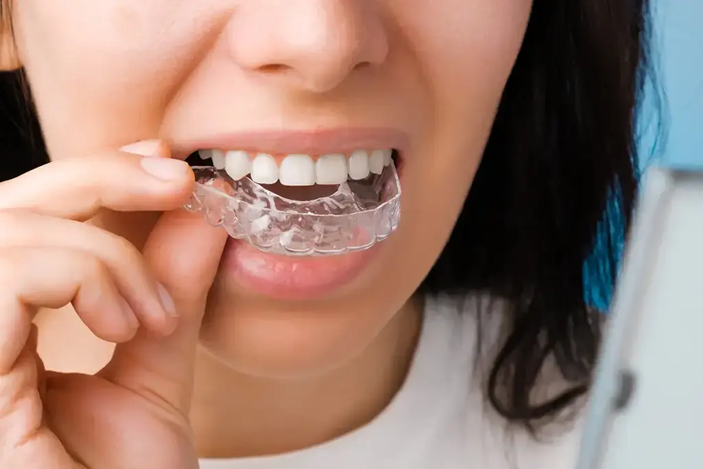 Bone Grafting In Plano
