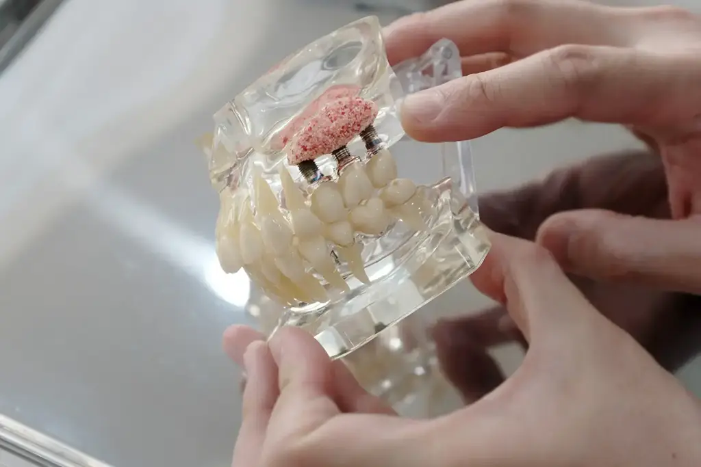 Bone Grafting In Garland