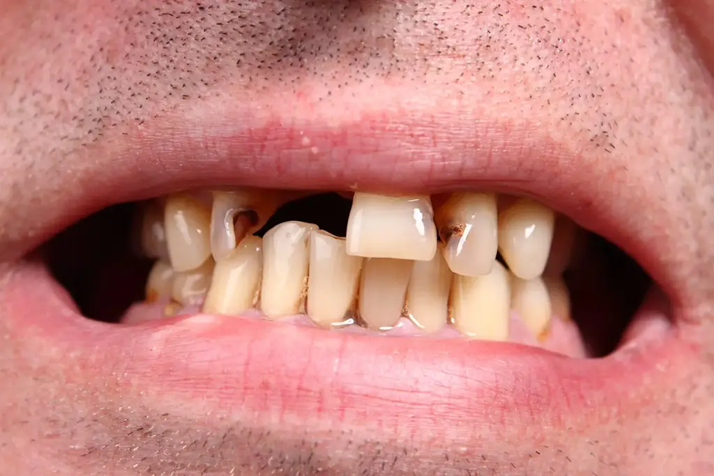 Cosmetic Dentistry In Garland