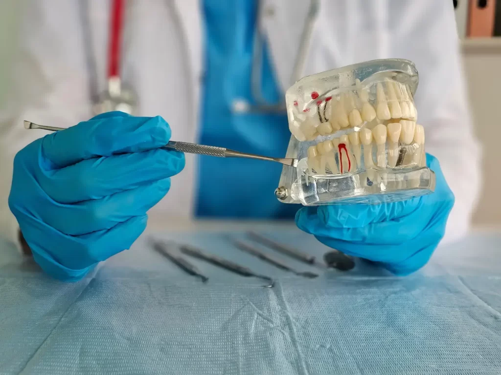 Benefits of Root Canal Therapy for Saving Natural Teeth