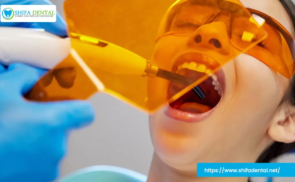Affordable Dental Fillings in Plano