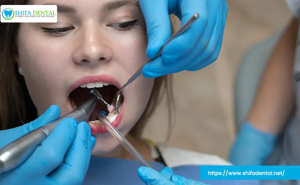 Dental Fillings in Plano